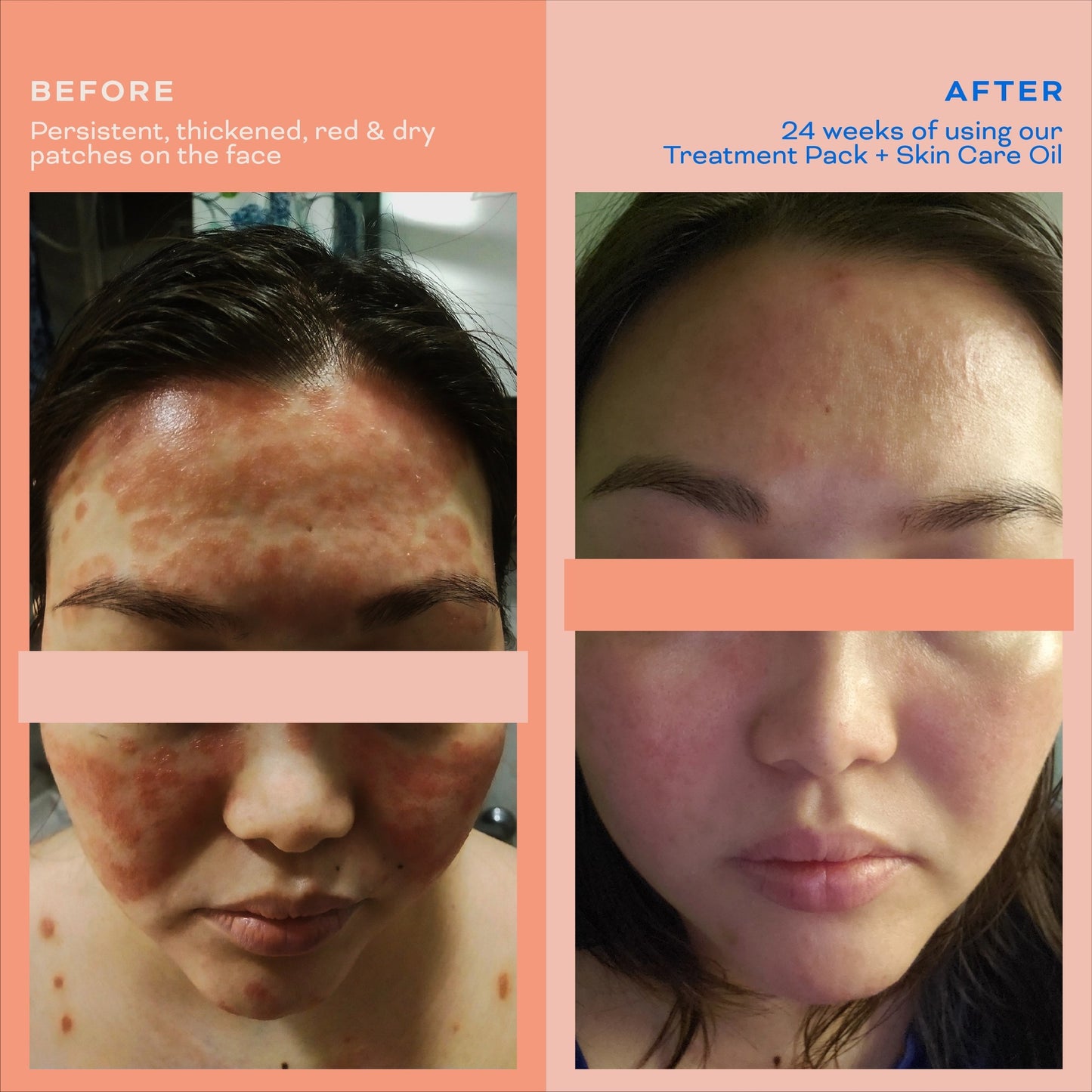Skin Care Oil