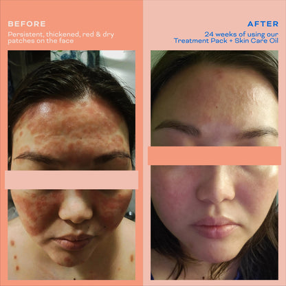 Skin Care Oil