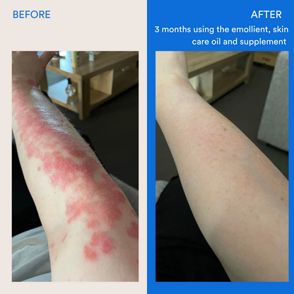 Small Emollient 50 g