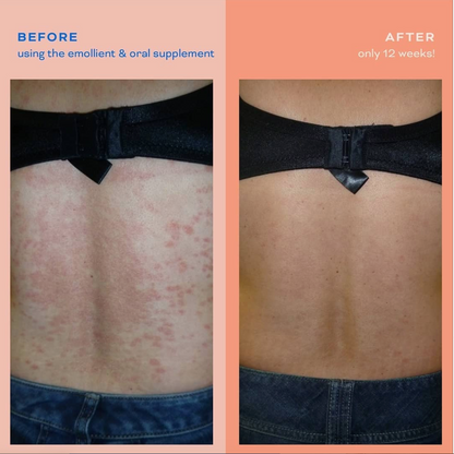 Small Emollient 50 g